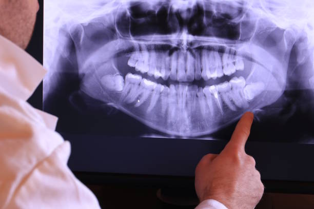 Best Emergency Dental Extractions in Devon, PA