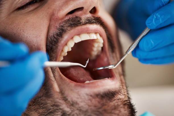 Best Broken or Cracked Tooth Emergency Dentist in Devon, PA