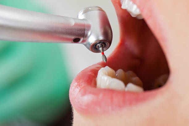 Best Emergency Dentist for Knocked-Out Tooth in Devon, PA